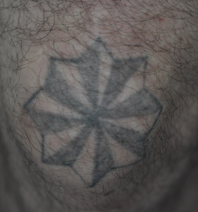 Tattoo Removal Treatment- Star Before Treatment . Sharplight