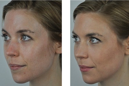 B&A15
