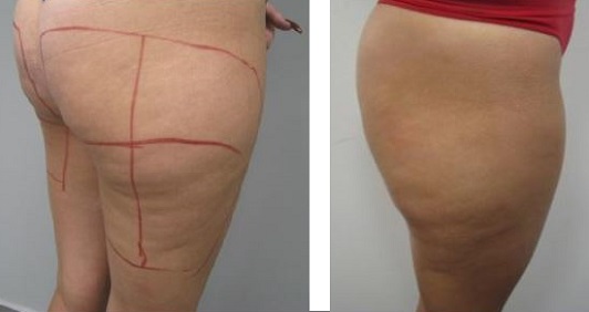B&A4
